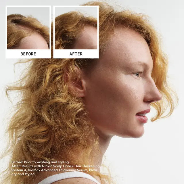 Nioxin Scalp + Hair Thickening System 4 Trio Pack PROGRESSED THINNING COLOURED / DRY / DAMAGED HAIR - Lashmer